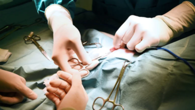 How to Choose the Right Surgeon for Duo Switch Surgery